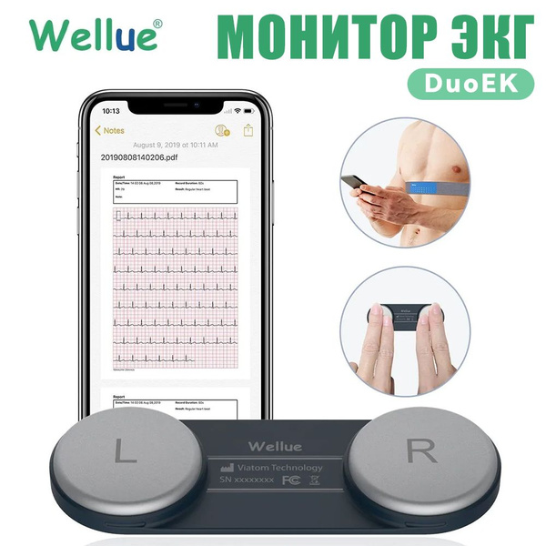 Монитор ЭКГ Wellue DuoEK Беспроводной портативный ЭКГ-монитор, монитор ...