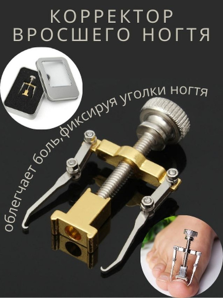 Корректор для выпрямления вросшего ногтя купить на OZON по низкой цене ...