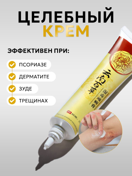 Крем от псориаза, дерматита, зуда, раздражения купить на OZON по низкой ...