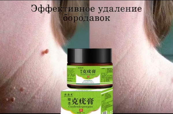 Крем для удаления бородавок и родинок 20g от папиллом и бородавок на ...