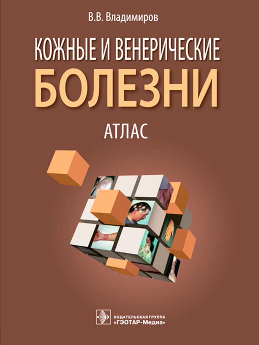 Атлас болезни. Книги атлас кожных болезней. Кожные и венерические болезни. Клинический атлас заболеваний кожи по Эндрюсу. Кожные и венерические болезни атлас б и Зудин.