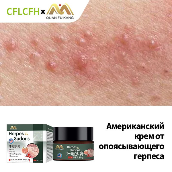 Мазь для интимной зоны от генитального герпеса, зуда, грибка и ...