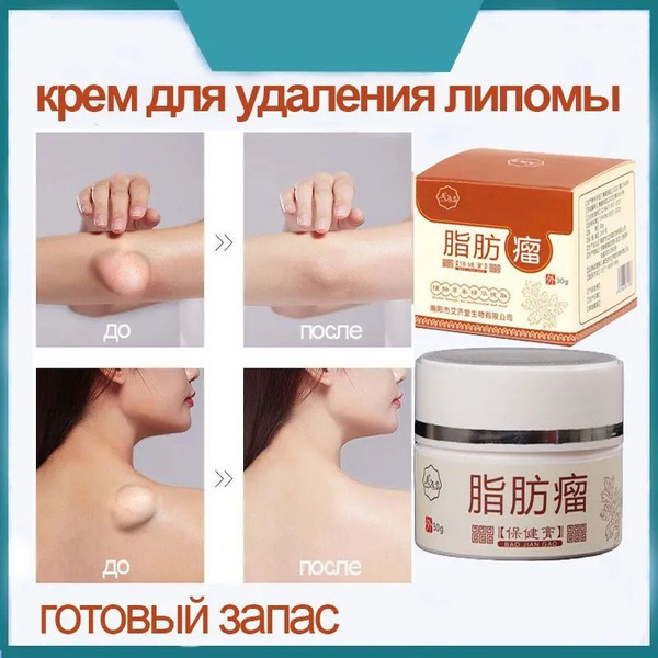 Гель для ног,гель для вен, 30 г ,от усталости и тяжести в ногах ...