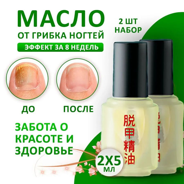 Масло для ногтей, средство от грибка и онихолизиса, SilaVeRes, 2 шт. по ...