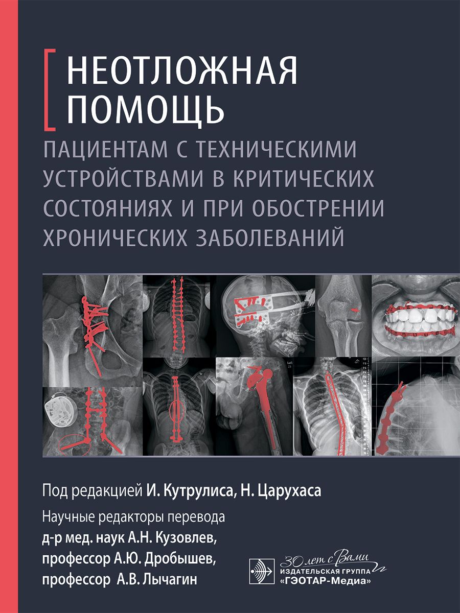 Неотложная помощь пациентам с техническими устройствами в критических состояниях и при обострении хронических заболеваний. Скорая помощь в экстренных ситуациях.