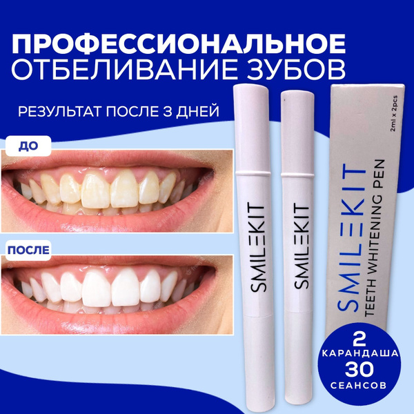 Карандаш отбеливающий Набор для эффективного отбеливания зубов дома 2 ...