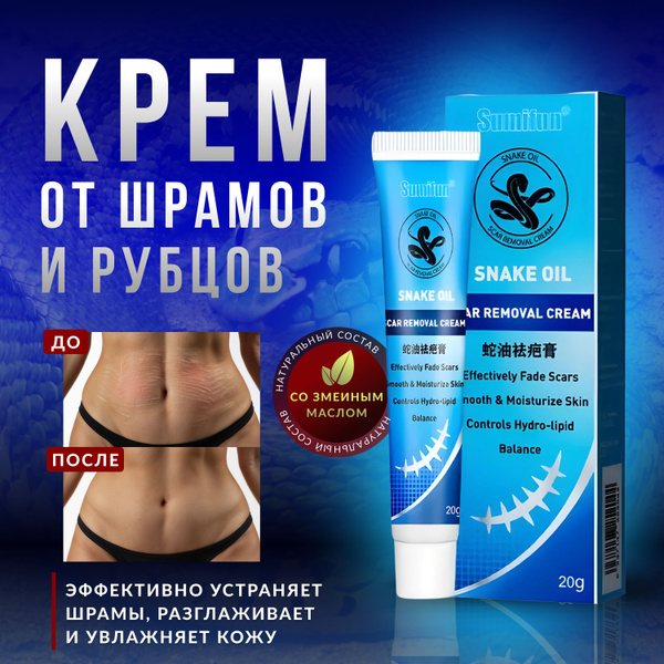 Крем от шрамов и рубцов - купить с доставкой по выгодным ценам в ...