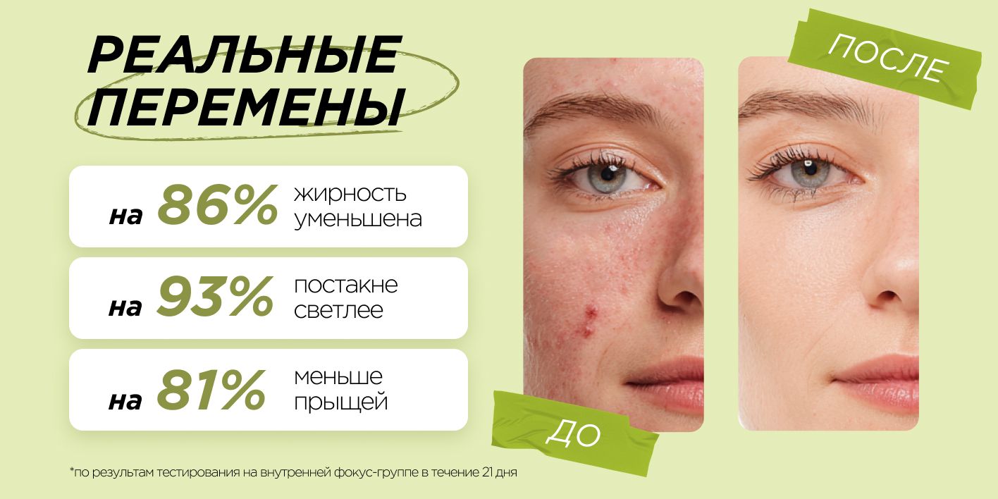 MIXIT Сыворотка для лица с ниацинамидом от прыщей SKIN CHEMISTRY, 30 м(图7)