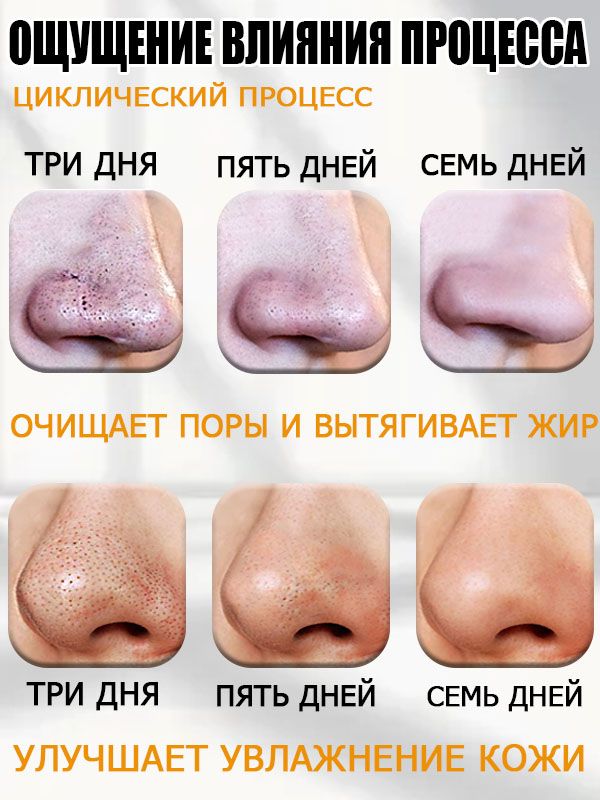 Маска пленка от черных точек, удаление акне, натуральные ингредиенты д(图5)