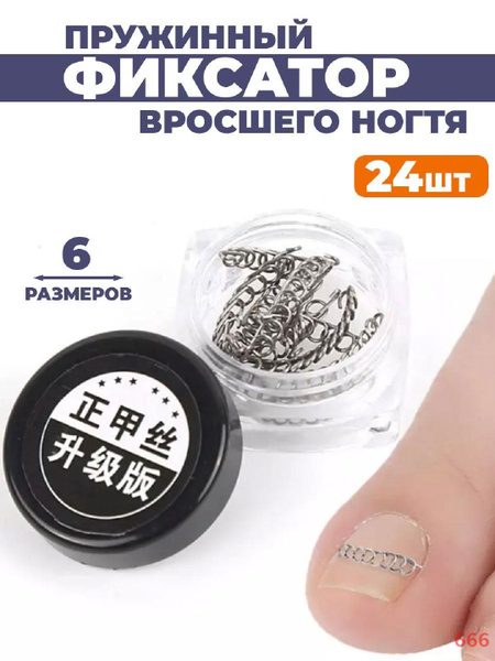 Корректор вросшего ногтя купить на OZON по низкой цене (1621063456)
