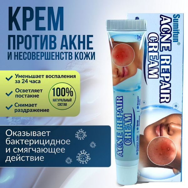 Китайская ЧУДО МАЗЬ от акне, прыщей, угрей купить на OZON по низкой ...
