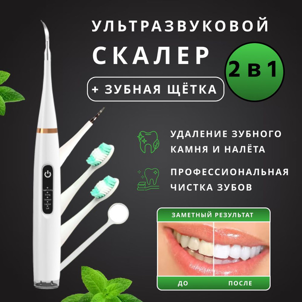 Скалер для удаления зубного камня купить на OZON по низкой цене ...