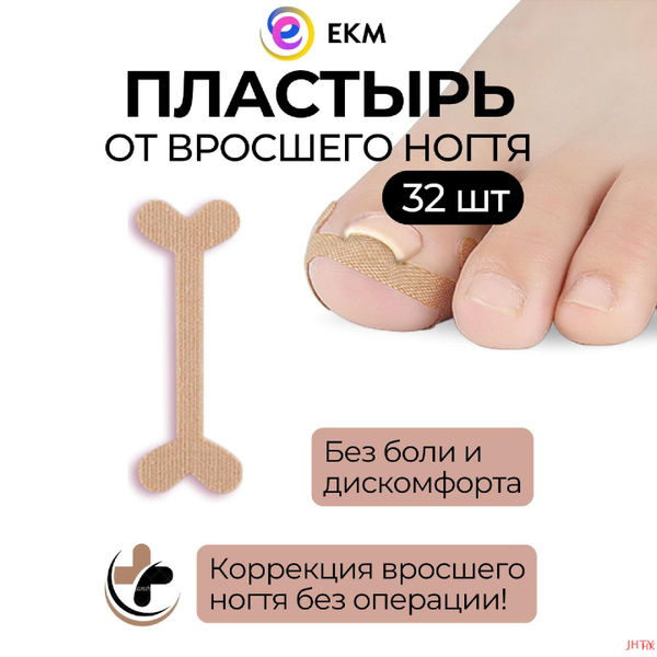 Корректор от вросшего ногтя ЕКМ EAF38BE0B156471EBE15D721B17C95C7 ...