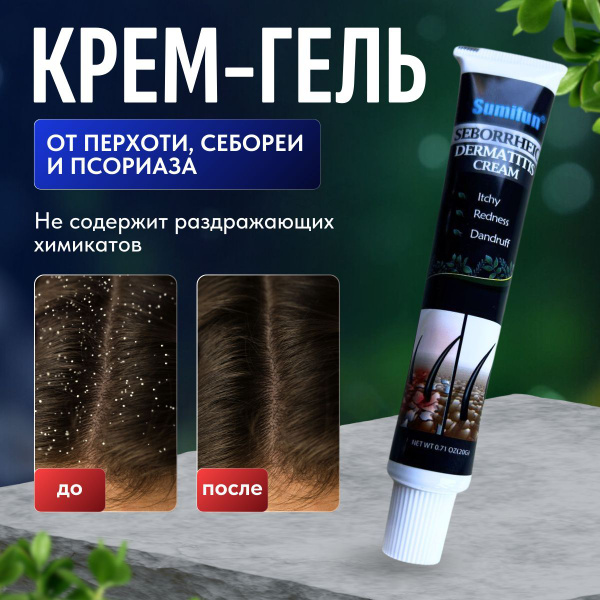 Крем гель для кожи головы от перхоти, зуда, псориаза купить на OZON по ...