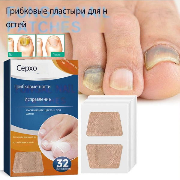 Пластырь от грибка ногтей и кожных заболеваний /Устранение грибковых ...