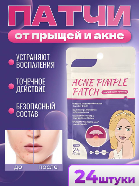 Прозрачные патчи-стикеры наклейки косметические от прыщей, угрей и акне ...