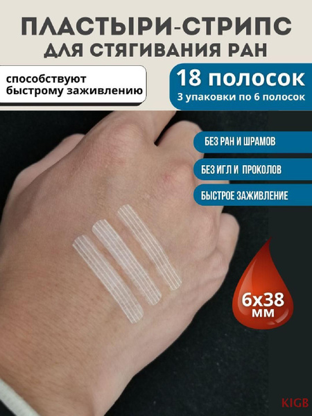 Пластырь для стягивания ран стрипс 6х38 мм, 18 полосок купить на OZON ...