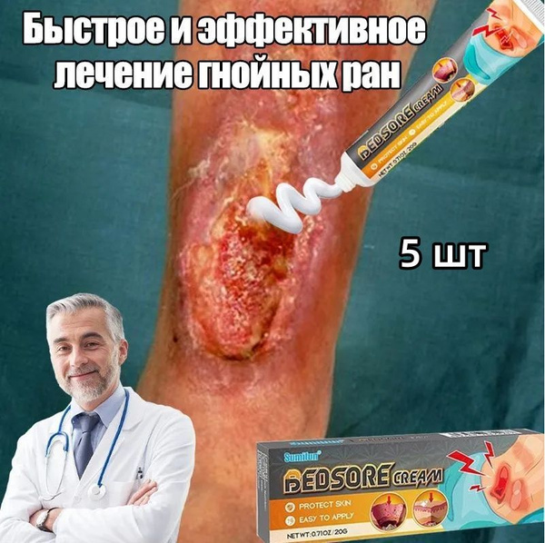 5 шт/Мазь от пролежней/заживляющий гель для ран и ожогов/для лечения ...