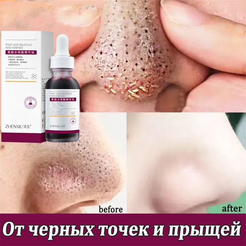 Сыворотка для...
