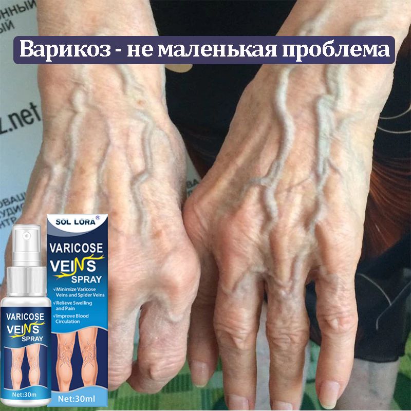 Спрей от...