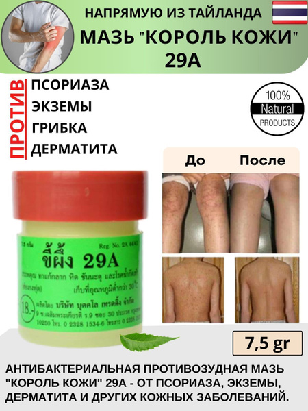 Мазь "Король кожи" от дерматита, псориаза, экземы и других кожных ...