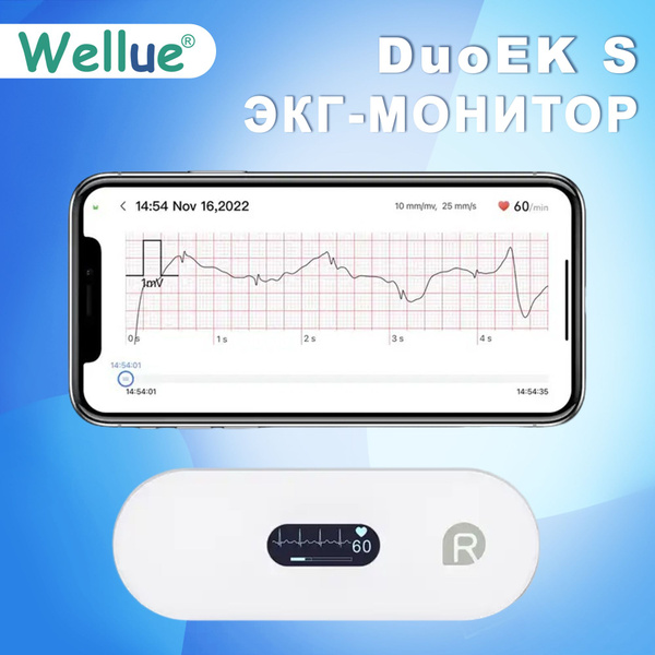 Кардиомонитор Wellue DuoEK S-3, белый - купить по низким ценам в ...