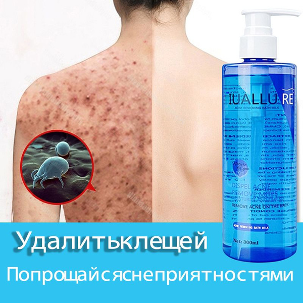 IUALLURE Гель для душа от прыщей, черных точек, акне и пигментных пятен ...