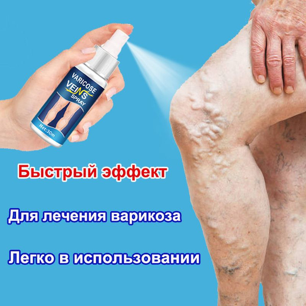 SOL LORA Спрей от варикоза, 30мл , эффективен при сосудистых звездочках ...