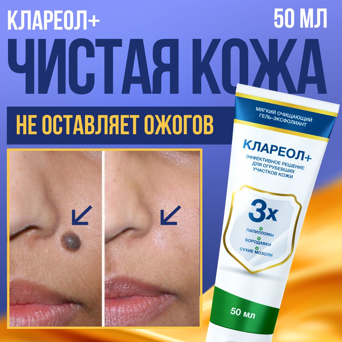 Клареол Гель От Папиллом Купить В Спб