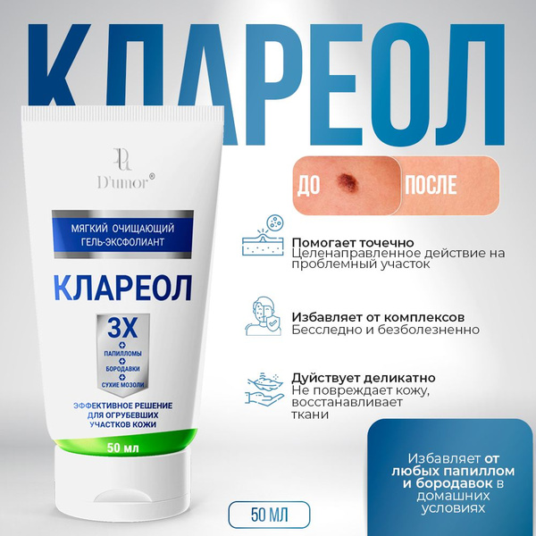 Клареол гель от папиллом / Гель эксфолиант, чистотел от папиллом, для ...