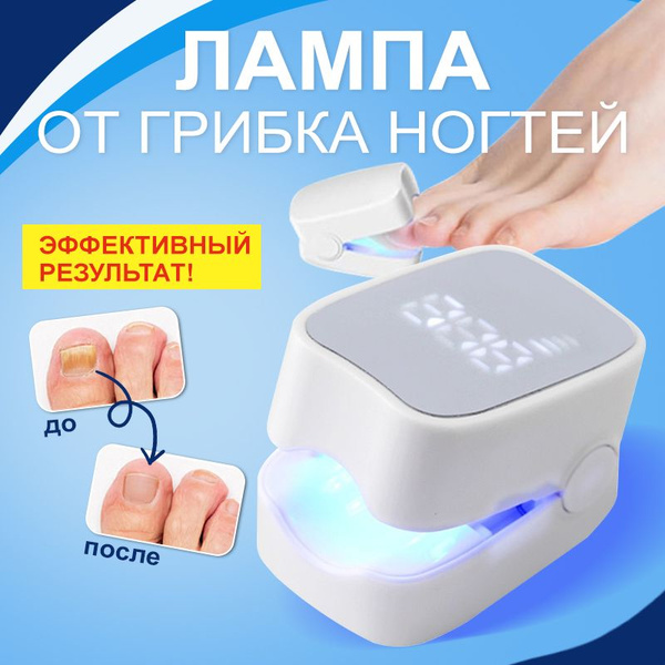 Оборудование для лечения грибка ногтей купить на OZON по низкой цене ...