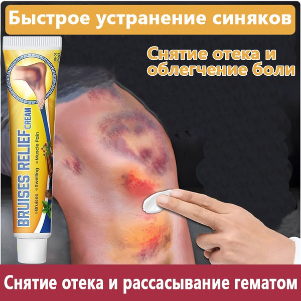 Крем бальзам для тела при синяках sumifun 30 мл ушибов, гематом, отеков ...