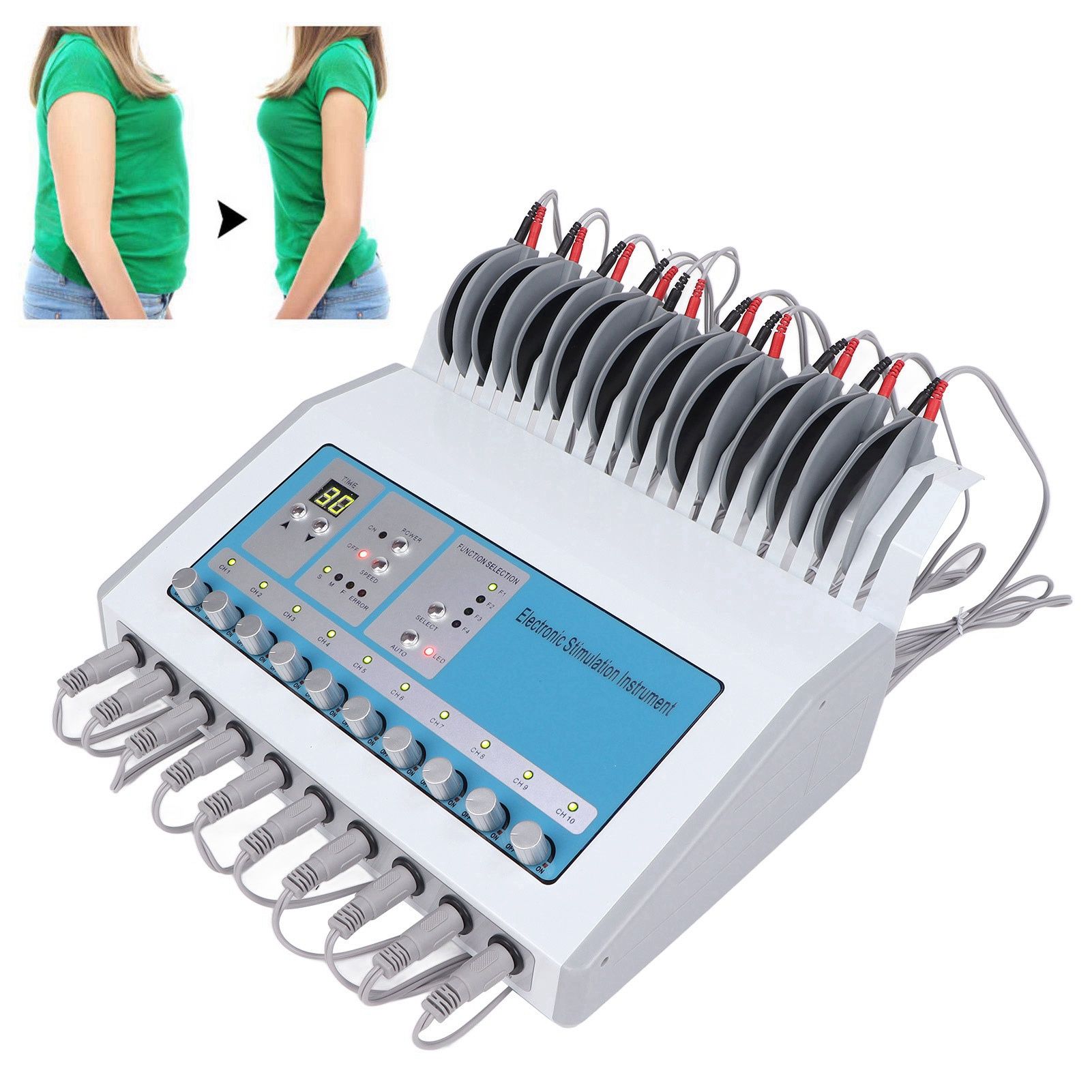 Electrical muscle stimulation. Миоритм 040. Электромиостимулятор