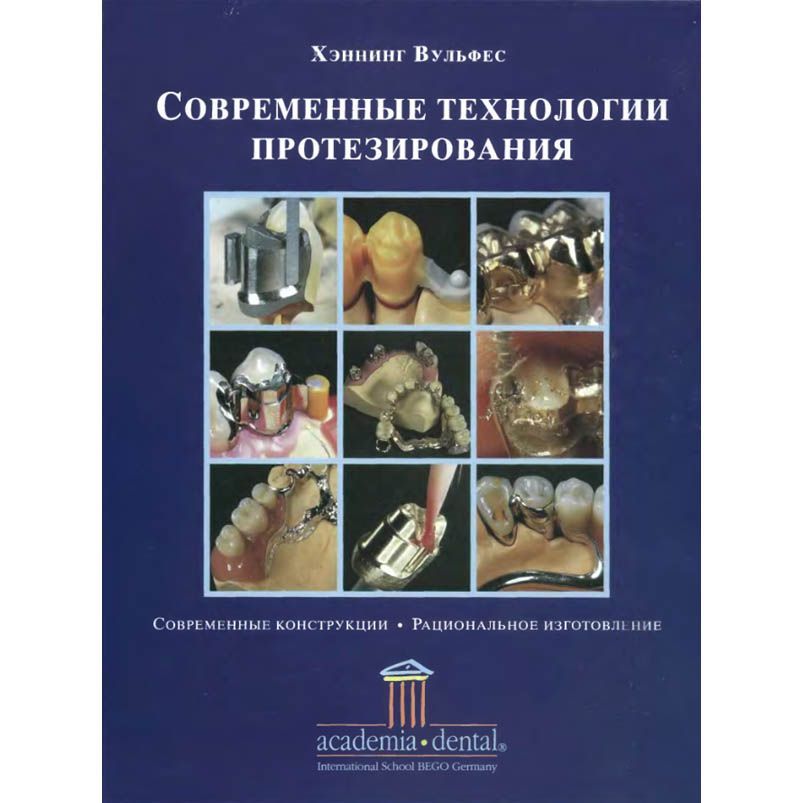 Учебник для зубных техников. Нанесение керамики зубной техник. Зубопротезная техника. Книга для зубного техника. Хеннинг вульфес современные технологии протезирования.