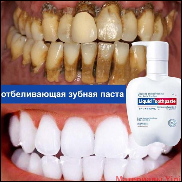 Пробиотики укрепляющая Зубная паста отбеливающая 200г с дозатором, для ...