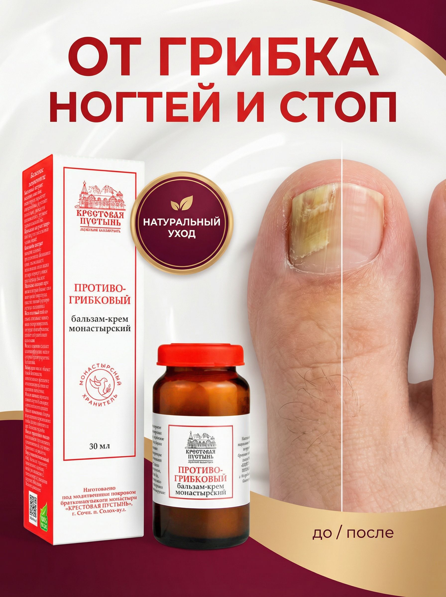Бальзам-крем от грибка ногтей монастырский