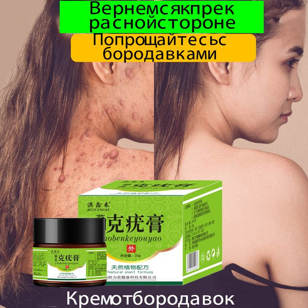Вопросы и ответы о Клареол гель от папиллом / Гель эксфолиант, чистотел ...