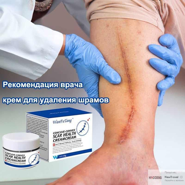 Медицинский крем от шрамов 30г, быстрая починка рубцов, от постакне ...