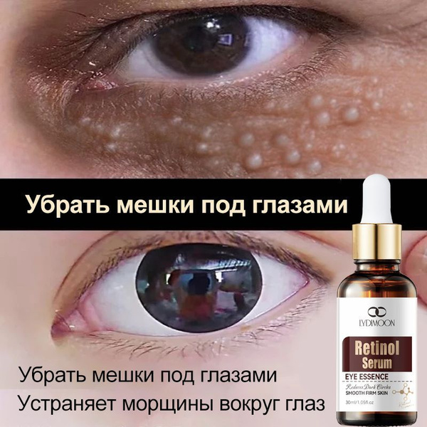 LYDIMOON ретинол для лица крем для век и кожи вокруг глаз от морщин ...