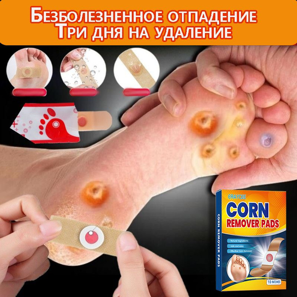 Пластырь разгрузочный от мозолей и натоптышей ,лейкопластырь для ног,10 ...