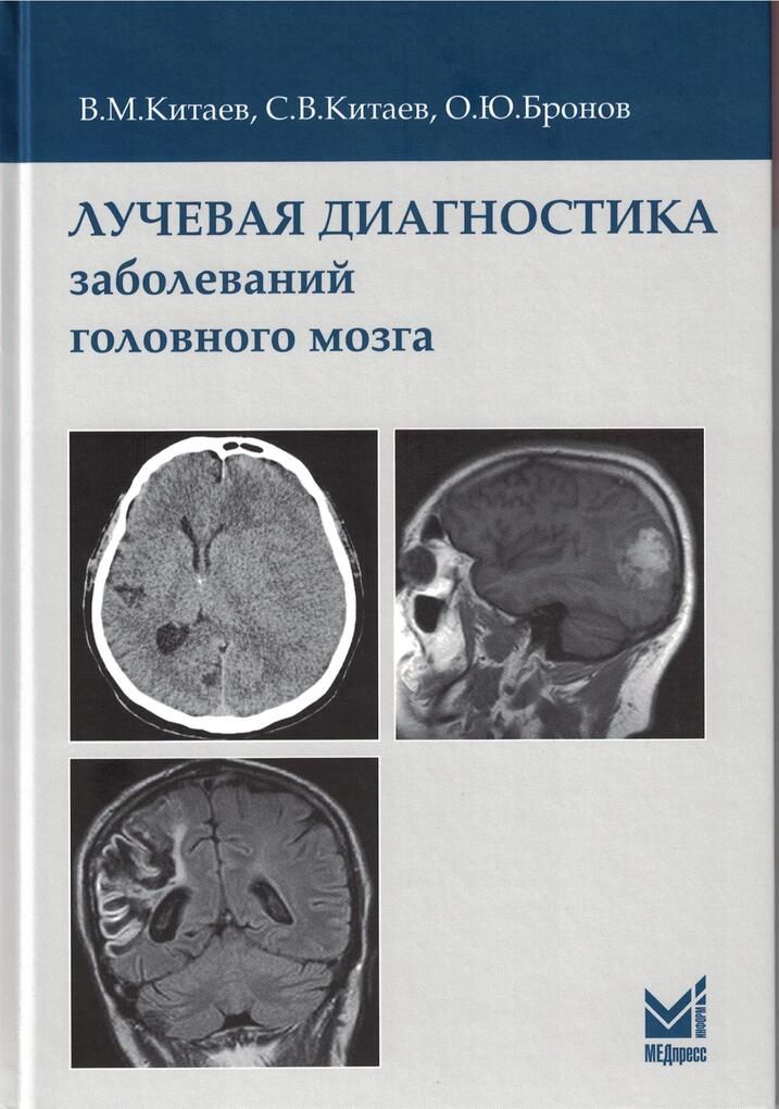 Лучевая диагностика заболеваний головного мозга