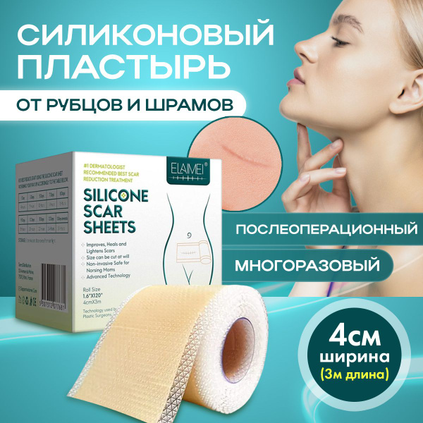 Силиконовый пластырь от шрамов и рубцов 4х300 см - купить с доставкой ...