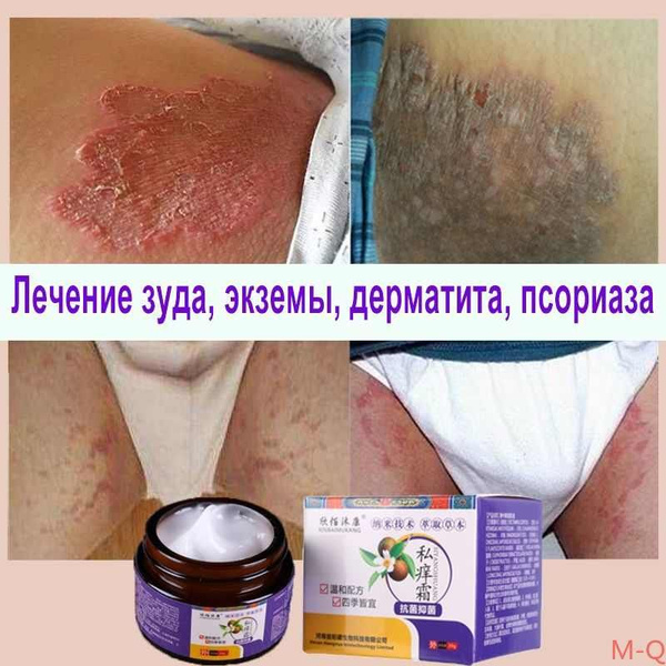 Успокаивающий крем-гель от зуда, воспаления и раздражения в интимных ...