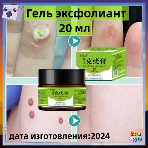 Клареол гель от папиллом / Гель эксфолиант, Крем от бородавок 20 мл ...