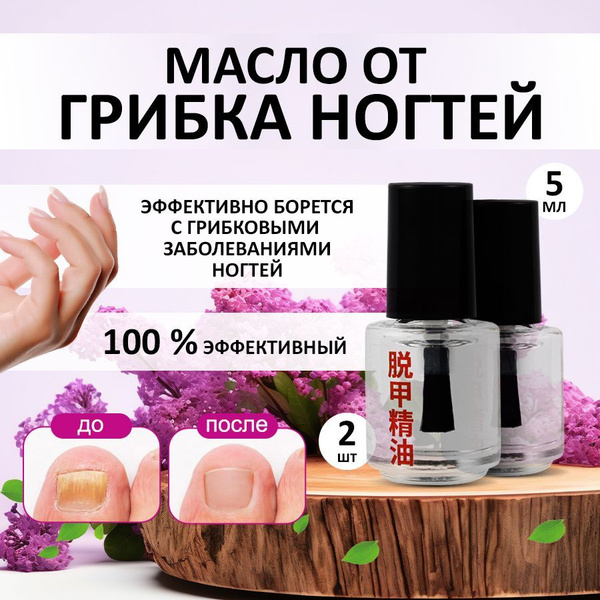 Средство от грибка ногтей на ногах, SilaVeres, стоп онихолизис, 2х5 мл ...