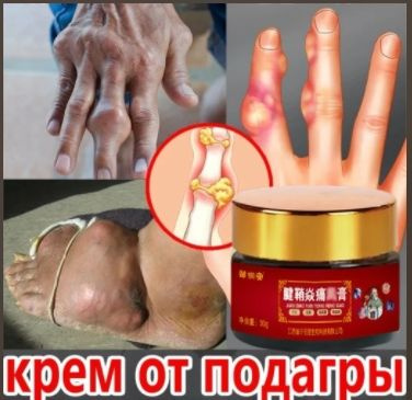 крем от подагры 30 г против покраснения и отеков суставов рук и ног от ...