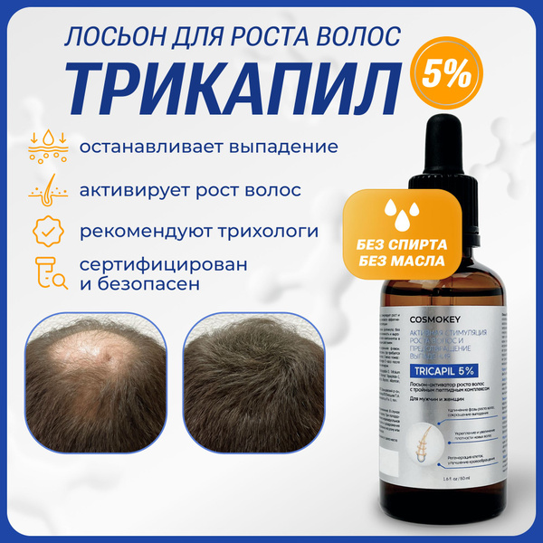 5% Средство для роста бороды и волос, лосьон против выпадения волос и ...