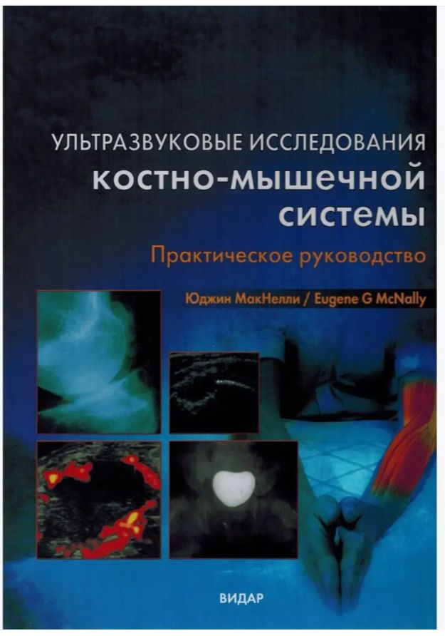 Ультразвуковая диагностика костно-мышечной системы. Практическое руководство | МакНелли Юджин