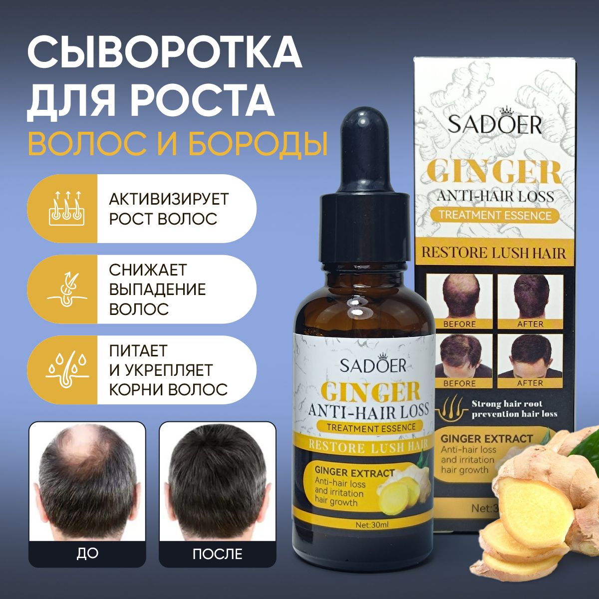 Сыворотка для роста волос, против выпадения и облысения Sadoer Ginger инновационная формула