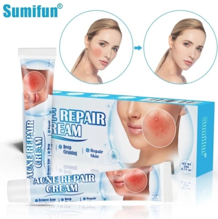 Acne Repair Cream Sumifun 20